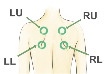 pnoi-rec-locations-alt